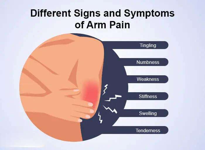 arm pain anxiety