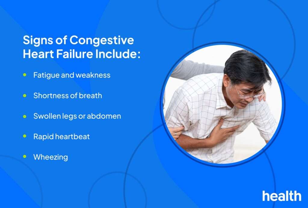 4 stages of pneumonia
