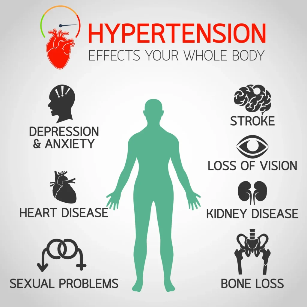 Hypertension is not a type of cardiovascular disease.